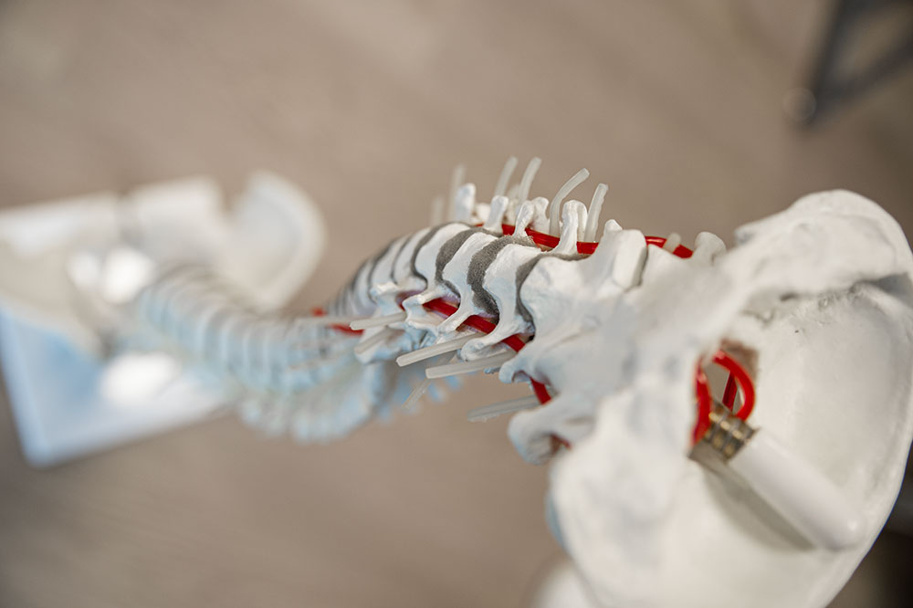 behandling af Spinalstenose hos kiropraktor